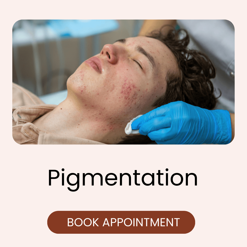pigmentation treatment
