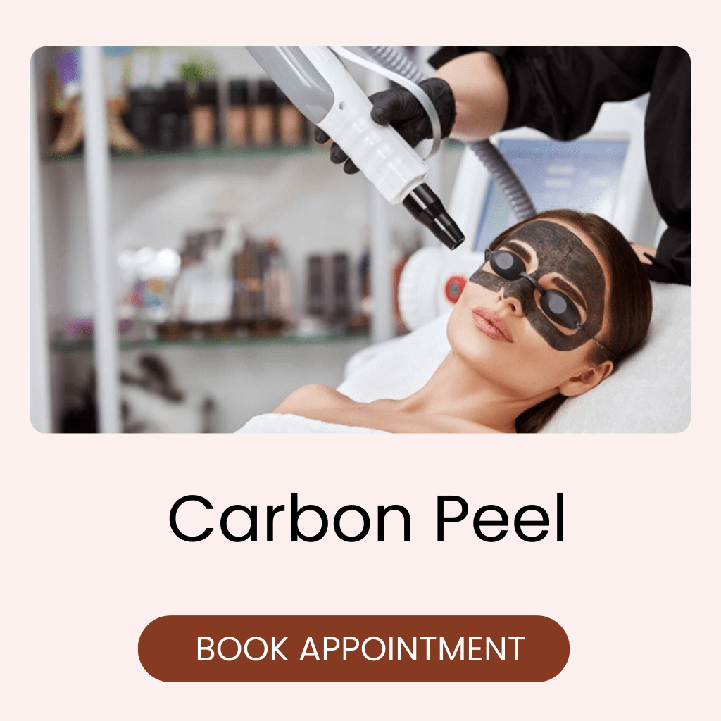carbon peel treatment in bangalore